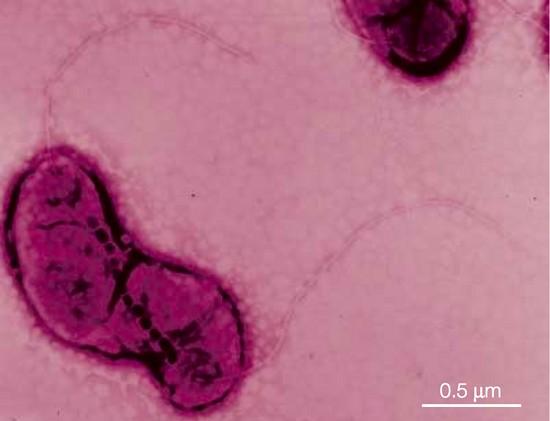 Bacteria Magnetospirillum magnetotacticum ¿Qué tienen en común una bacteria y los ferrofluidos?