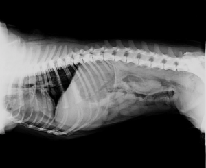 La desaparición quirúrgica de la hernia intervertebral