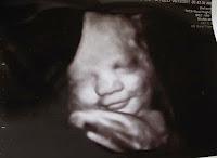 El lenguaje corporal y los gestos que hablan de ti. Ecografía de bebé sonriendo El lenguaje corporal y los gestos que hablan de ti. Ecografía de bebé sonriendo