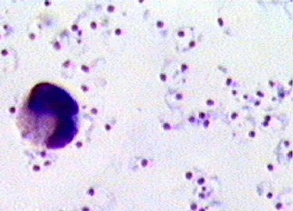 plasmodiumfalciparum26 Día Mundial de la Malaria