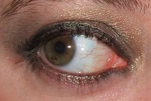 Look