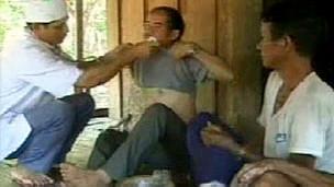 (417) LA EXTRAÑA ENFERMEDAD QUE DEJA PERPLEJOS A LOS EXPERTOS (417) LA EXTRAÑA ENFERMEDAD QUE DEJA PERPLEJOS A LOS EXPERTOS