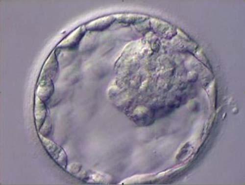 Blastocito. Foto Arturo Reyes Palomares blastocito_arturo_reyes_palomares