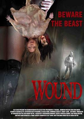 Wound review