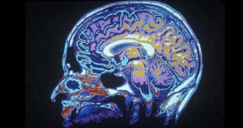 Neurociencia: una breve guía foto fMRI Neurociencia: una breve guía