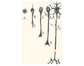 El cerebro se degenera: ¿Se puede evitar? El cerebro se degenera: ¿Se puede evitar?
