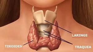 Tiroidectomía Tiroidectomía para tratar la apnea obstructiva de sueño