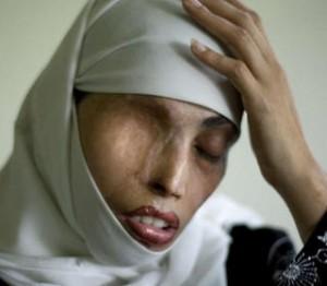 Los islamistas piden lanzar ácido a las mujeres que hablen por teléfono