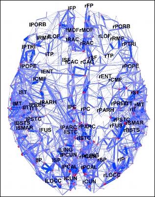 Unas conexiones cerebrales sanas ayudan a conservar la inteligencia en la vejez