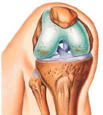 Un chip para ver la progresión de la artrosis de rodilla