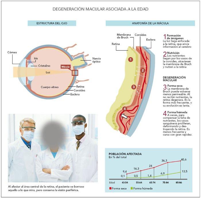 Degeneración macular asociada a la edad (DMAE). (I). Paperblog