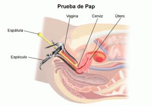 citologia Las mujeres debería hacerse una citología vaginal anual ¿En que consiste la citología vaginal?