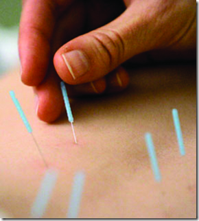 Los Acufenos y La Acupuntura Como Tratamiento Los Acufenos y La Acupuntura Como Tratamiento