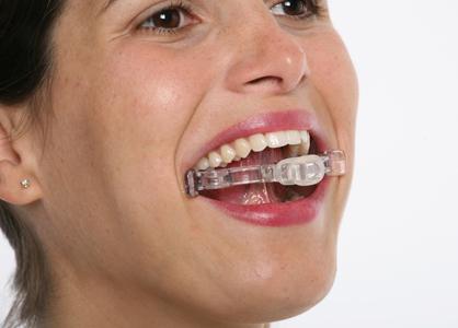 gym face Gym Face: ejercita los músculos del rostro