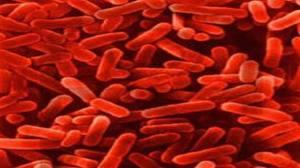 Los expertos advierten sobre cepas de gonorrea resistentes a antibióticos