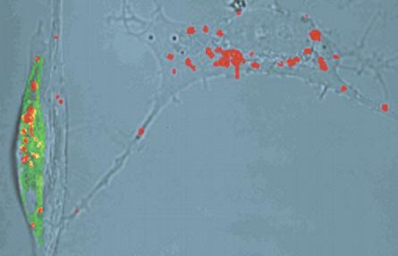 Alzheimer ¿cuestión de priones? Alzheimer ¿cuestión de priones?