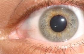color ojo El color de ojos puede ayudar a predecir cierta predisposición al vitíligo y al cáncer de piel