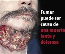 Luz verde a las imágenes repulsivas en las cajetillas de tabaco en España