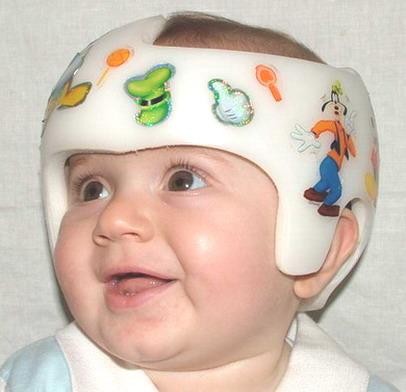 Mi niño tiene la cabeza achatada: Plagiocefalia postural