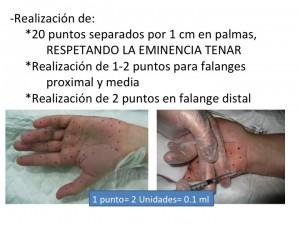 Hiperhidrosis Hiperhidrosis