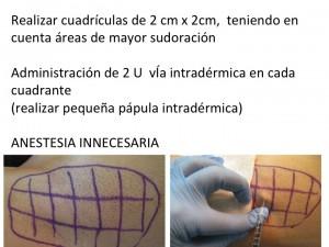 Hiperhidrosis Hiperhidrosis