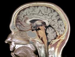 cerebro-inteligencia-gen Identificación de genes involucrados en el sistema nervioso