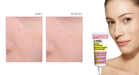 efectos del antes y después de usar Z-Pore efectos del antes y después de usar Z-Pore