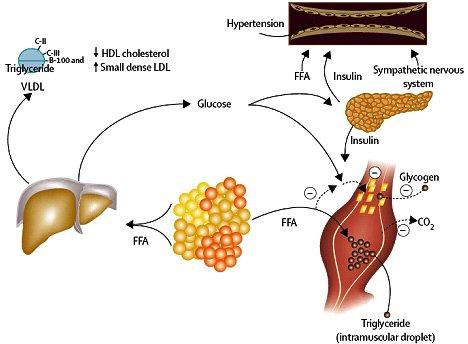 Uso de tratamientos basados en la evidencia después de un síndrome coronario agudo Uso de tratamientos basados en la evidencia después de un síndrome coronario agudo