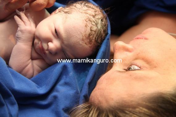 imagen parto Cesárea versus parto natural