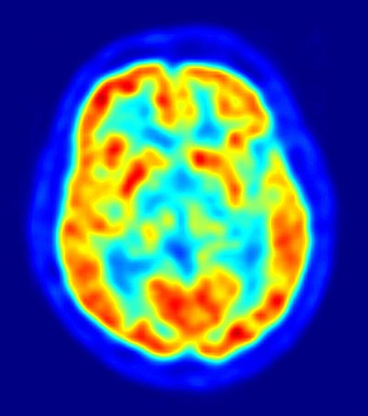 PET Tomografíia por emisión de positrones Los instrumentos de investigación más utilizados en Neuropsicología