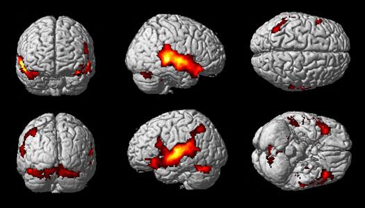 Resonancia magnetica funcional Los instrumentos de investigación más utilizados en Neuropsicología