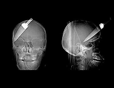 Radiografías raras