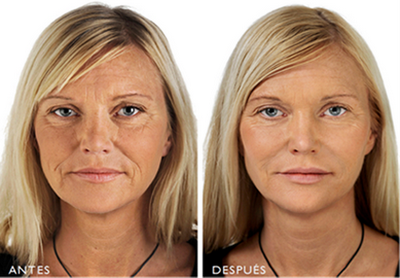 Hedonai y sus tratamientos faciales Hedonai y sus tratamientos faciales