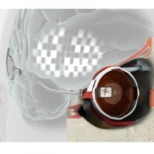 Se implanta el primer ojo “biónico” en un humano