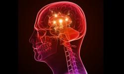 La epilepsia puede derivar a mayores anormalidades en el cerebro con el tiempo