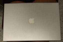 Eritema ab igne inducido por laptop Eritema ab igne inducido por laptop