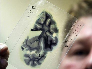 Científicos descubren principios que crean conexiones entre neuronas Científicos descubren principios que crean conexiones entre neuronas