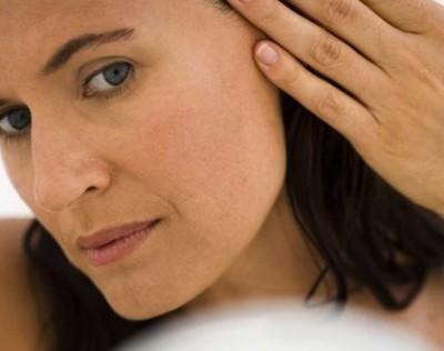 manchas-edad Cómo remover manchas de la edad en cuestión de semanas