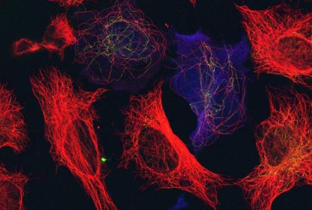 Estudian las propiedades de los microtúbulos de las células, en las cuales se basan muchos tratamientos antitumorales Estudian las propiedades de los microtúbulos de las células, en las cuales se basan muchos tratamientos antitumorales
