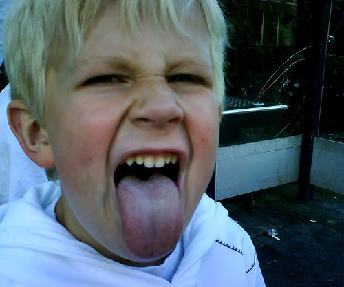 niños-lengua Los niños obesos tienen las papilas gustativas menos desarrolladas