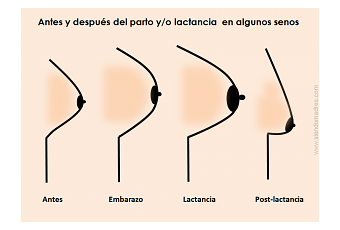 Aumentará el pecho femenino