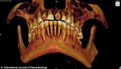 Encuentran momia egipcia de 2.100 años de antigüedad con empastes en los dientes.