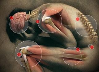 El Síndrome de Hipermovilidad Articular (SHA) · Síntomas El Síndrome de Hipermovilidad Articular (SHA) · Síntomas
