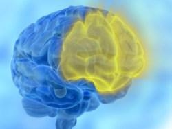 Neuromarketing Neuromarketing