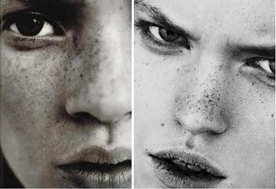 Pecas… ¿Nos gustan o no? Pecas… ¿Nos gustan o no?