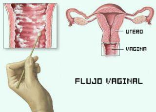 Flujo vaginal y ciclo menstrual