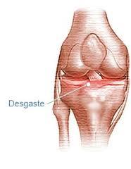 4 consejos para reducir el dolor en casos de artrosis de rodilla