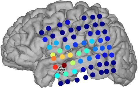 Anestesia y sueño: así se apaga y se reinicia la conciencia