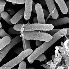 Nublado con posibilidad de microbios Nublado con posibilidad de microbios