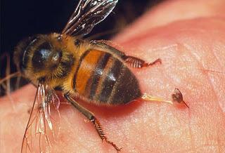 ¿Cómo sacar un aguijón de picadura de abeja o avispa?